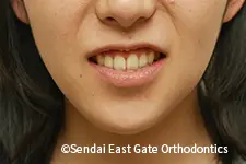 治療後