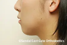 治療後