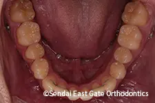 治療後
