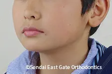 治療前
