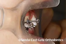 治療中