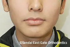 治療後