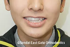 治療後