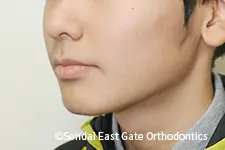 治療後