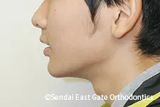 治療後