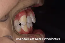 治療後