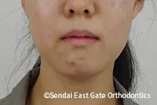 治療前