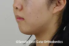 治療前