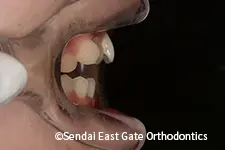 治療前