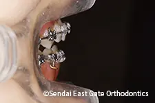 治療中
