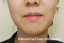 治療後