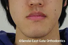 治療前