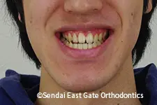 治療前