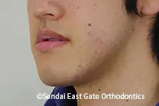 治療前