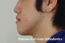 治療前