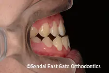 治療前