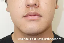 治療後