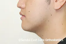治療後