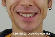 治療前