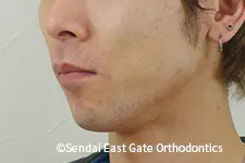 治療前