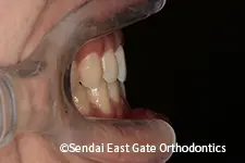 治療前