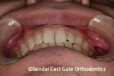 治療前