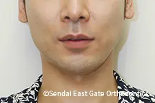 治療後