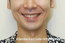 治療後