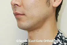 治療後