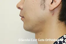 治療後