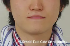 治療前