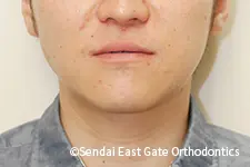 治療後