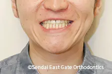 治療後