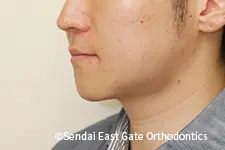 治療後