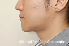 治療後