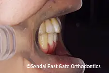治療後