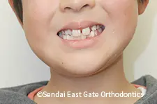 治療前