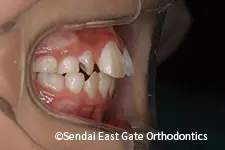 治療前