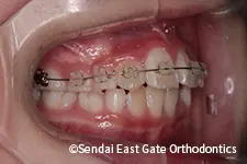 治療中