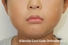 治療後