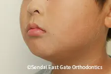 治療後