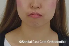 治療前