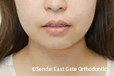 治療後