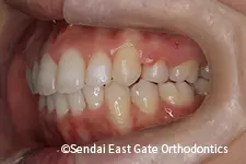 治療後