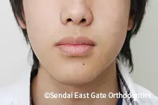 治療前
