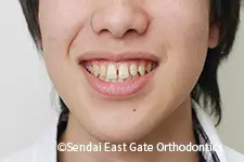 治療前