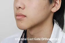 治療前