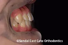 治療前