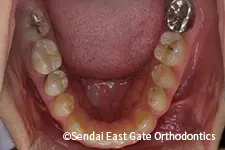 治療前