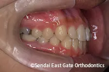 治療中